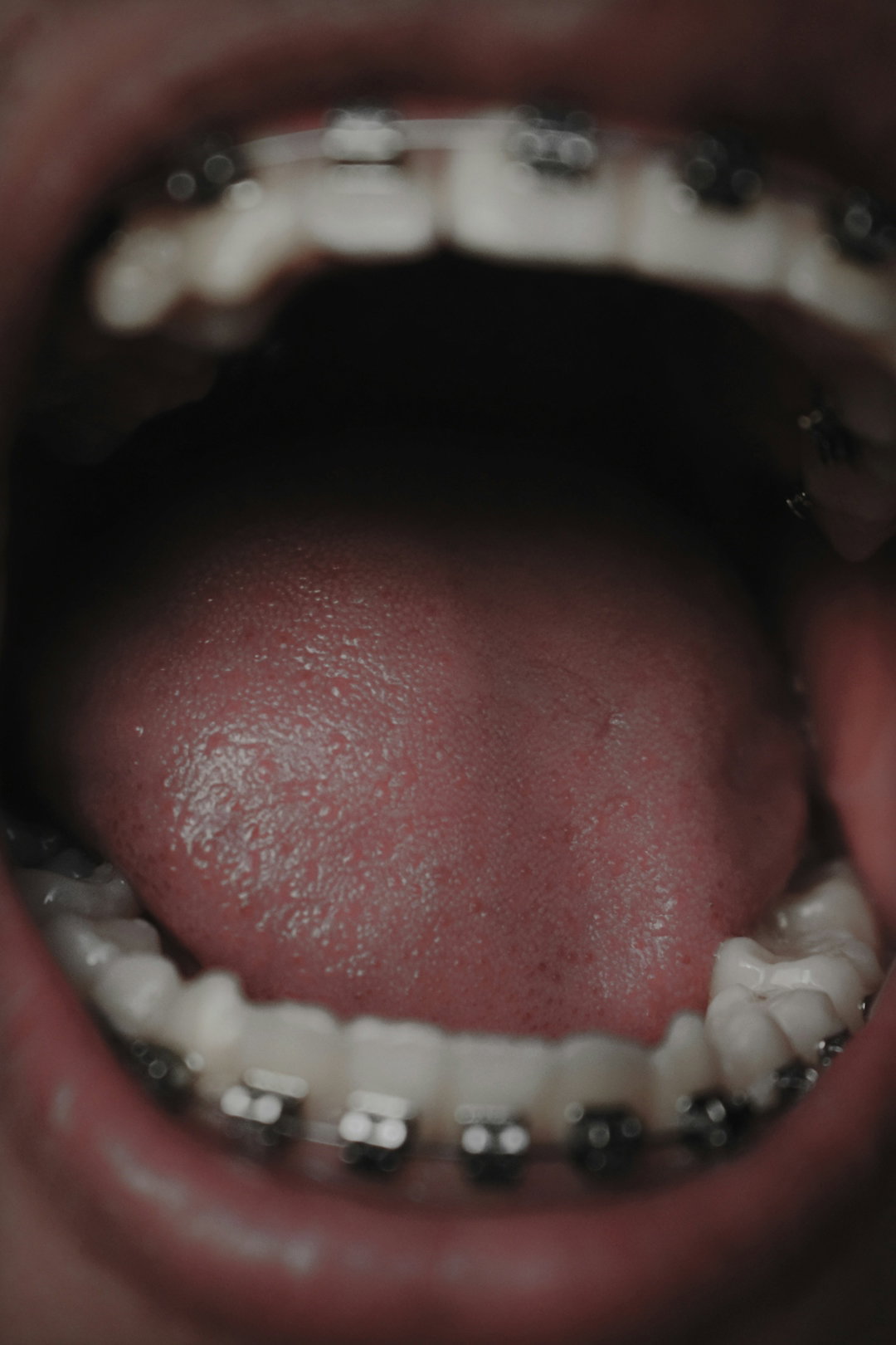 persons-mouth-open-in-close-up-photography.jpg persons mouth open in close up photography
